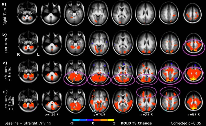 Figure 1: Relation between specific driving task and brain region activity using fMRI (Frontiers of Human Neuroscience)
