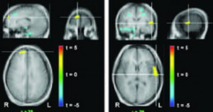 Response to 3D environment with activation in right superior fontal and left superior temporal gyrus