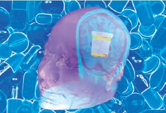 It’s All in Your Head: Measuring the Placebo Effect Using fMRI