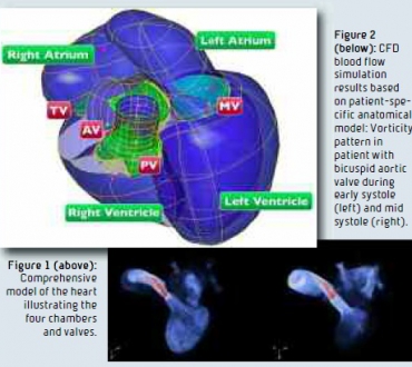 Large Scale Simulations in Pediatric Cardiology: Towards the Personalized Virtual Child Heart