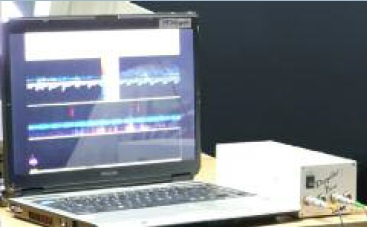 Figure 2. The Transcranial Doppler unit used in the experiments (Doppler-Box Compumedics Germany GmbH) is connected to a PC in which BFV signal can be visualized.